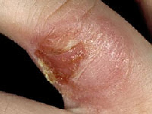 school sores 2