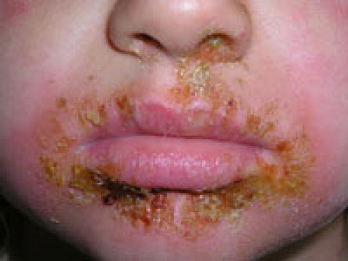School Sores 1
