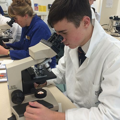 Sam gets up close and personal with the bacteria living on his teeth